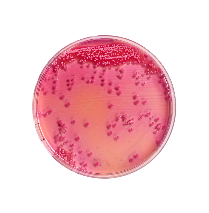 Petri 2 – PerioTrap